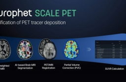 Neurophet acquires Singaporean certification for Alzheimer's diagnosis 