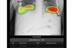 Lunit to supply AI image analysis solutions to Samsung Electronics