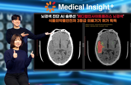 SK C&C wins Korea’s nod for brain infarct diagnosis AI solution
