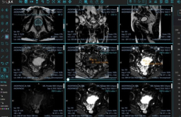 JLK gets FDA OK for prostate cancer diagnosis AI solution
