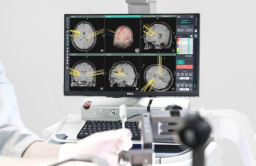 Koh Young gets OK from FDA for brain surgery robot